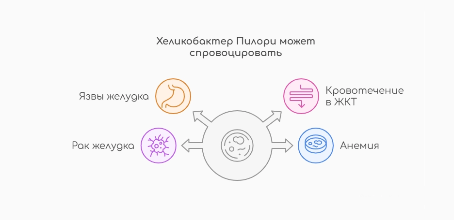 Хеликобактер Пилори может спровоцировать (инфографика)